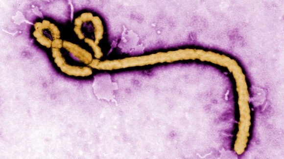 Il virus Ebola al microscopio