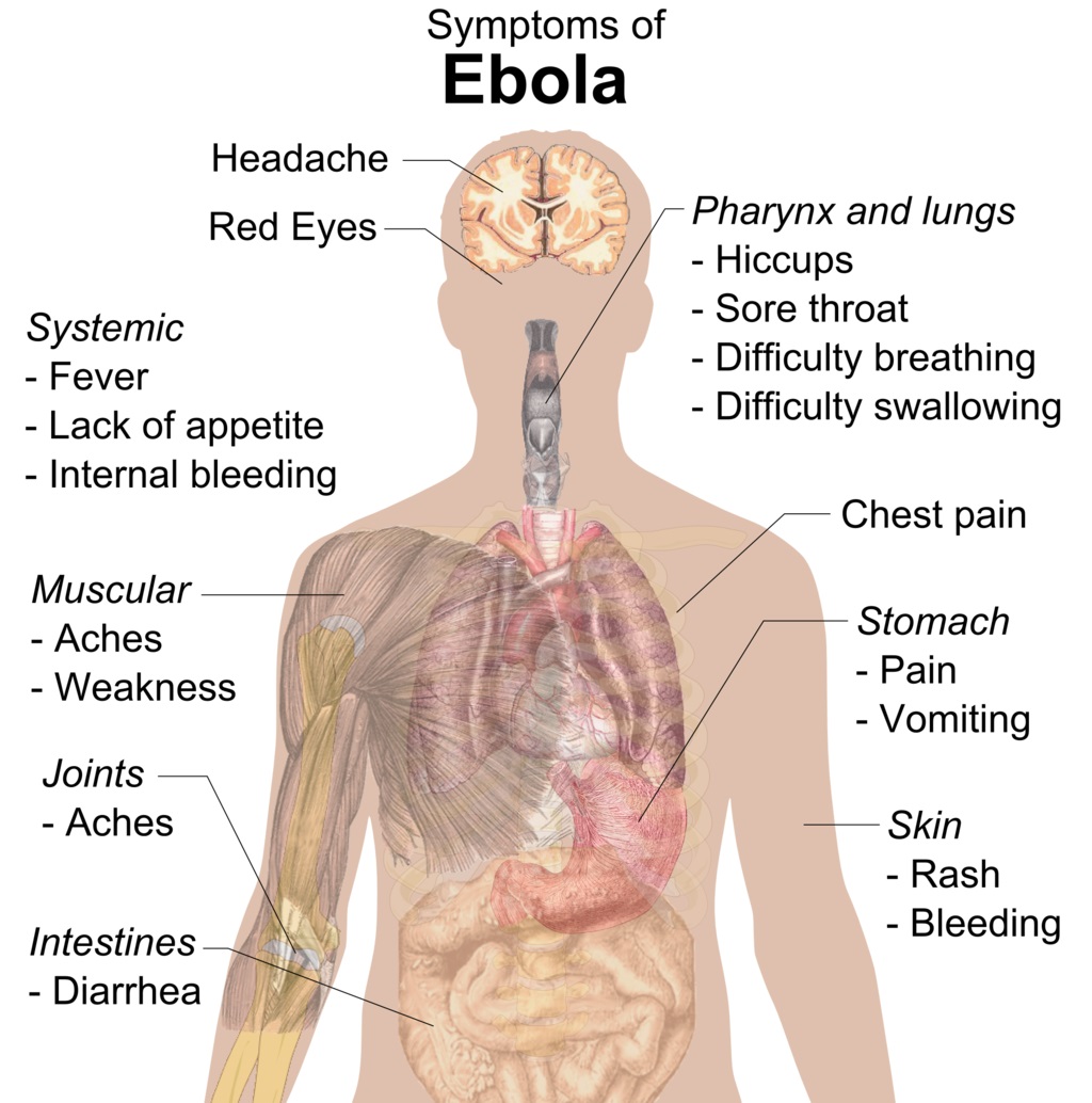 ebola epidemia sintomi virus