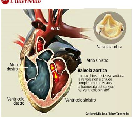 silvio berlusconi valvola aortica